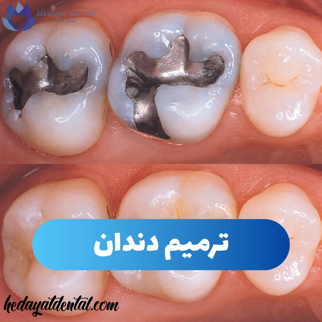 راهنمای کامل دندانپزشکی و ترمیم دندان